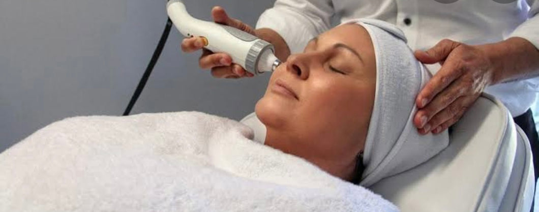 Fractional RF Skin tightening Full Face